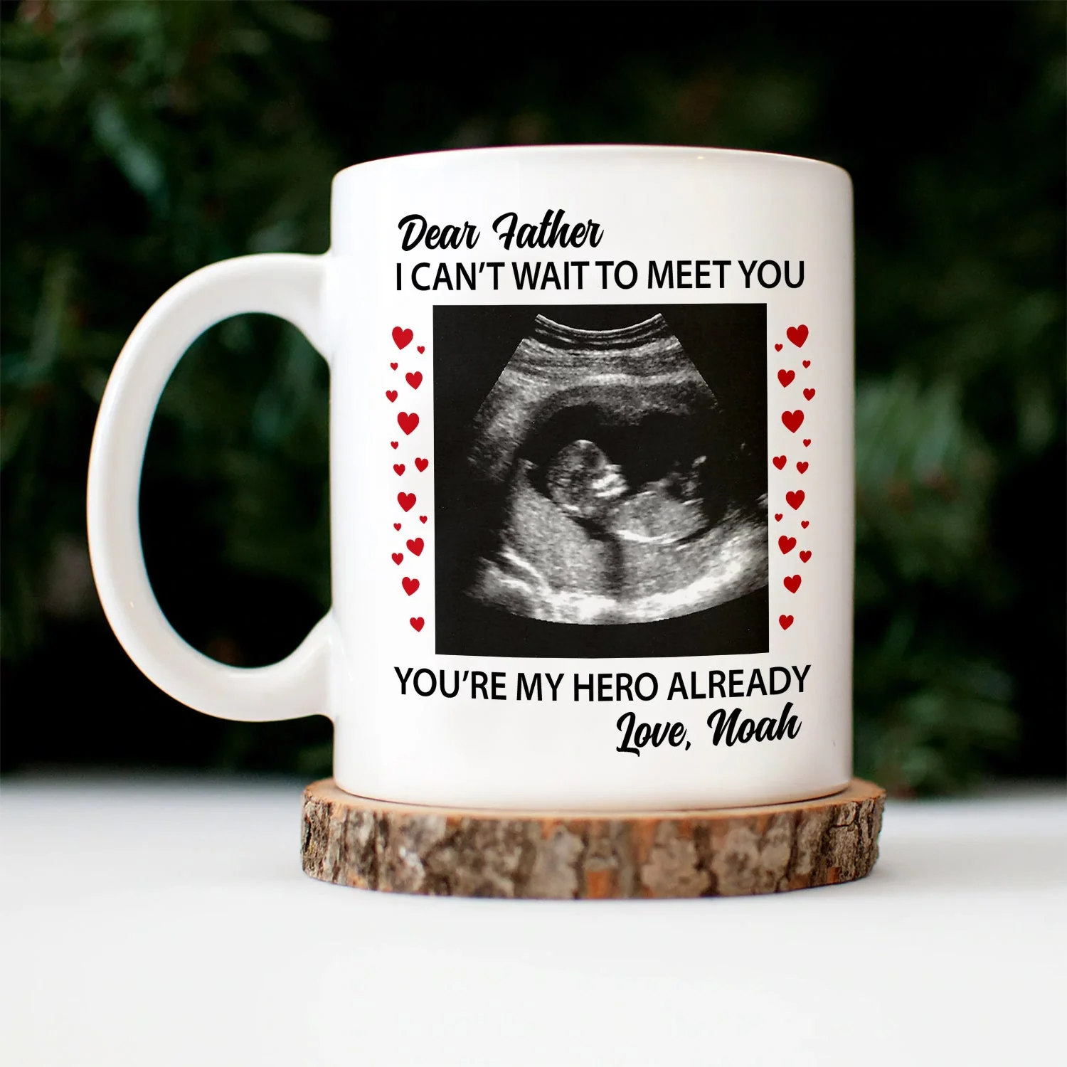 Custom Photo Baby Bump Can't Wait To Meet You - Pregnancy Gift - Personalized Mug - Image 3